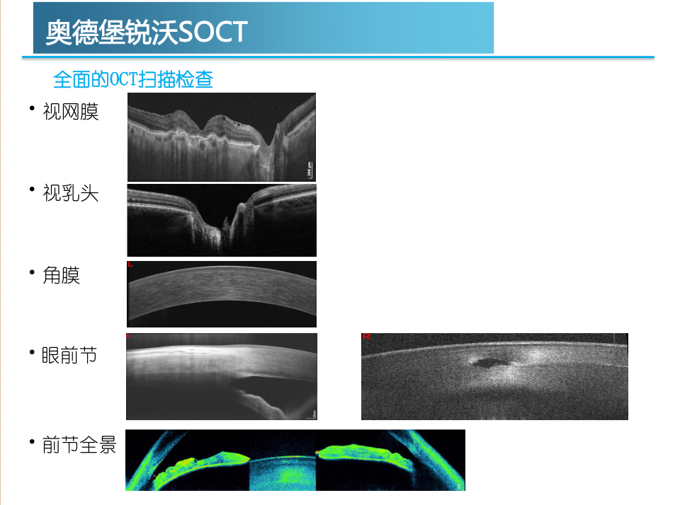 奥德堡REVO SOCT光学相干断层扫描仪